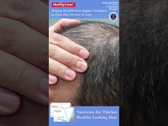 Αύξηση τρίχας